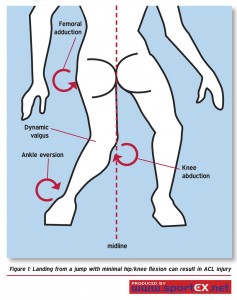 dynamic valgus